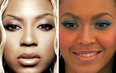 La rinoplastica di Beyonce