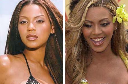 Beyonce prima e dopo la rinoplastica