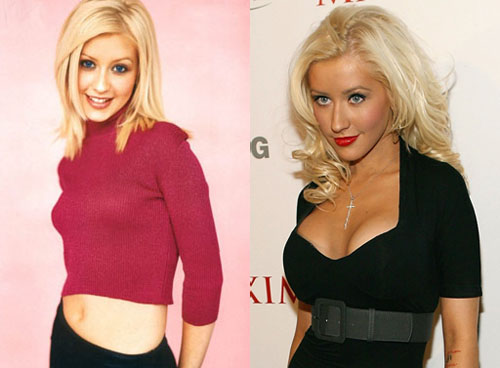 Christina Aguilera: protesi mammarie