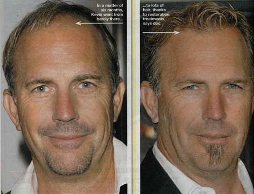 Kevin Costner
