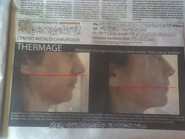 Foto pubblicità thermage 2