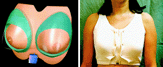 Reggiseno biomeccanico