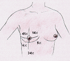 Quadranti della mammella